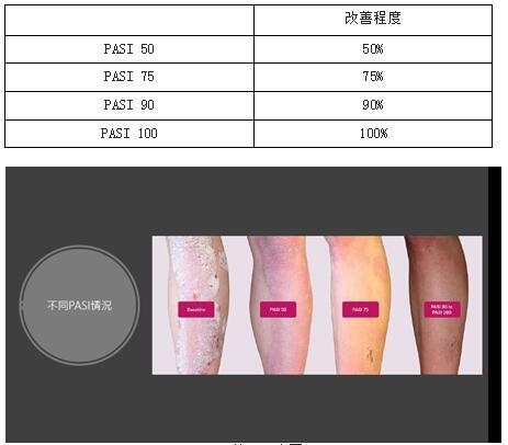 新一代生物制剂：银屑病患者疗效可达“PASI 100”！