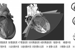 冠心病心包积液主动脉夹层和肺动脉高压超声成果怎样解读