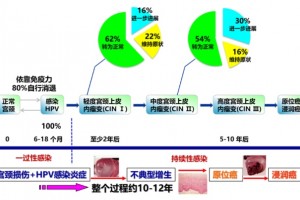 HPV感染“男女性伴同防同治”势在必行/罗新 述评